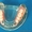 Нейлоновые зубные протезы #1212090