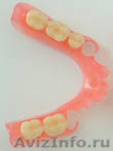 Съёмные зубные протезы на дому у пациента. - Изображение #2, Объявление #449817