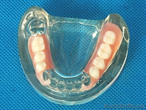 Нейлоновые зубные протезы - Изображение #1, Объявление #1212090